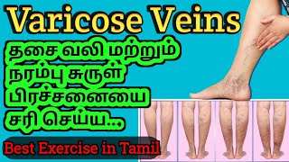 Get rid of varicose veinpain relief Exercises Best Sleeping position  Legend Healer [upl. by Hooper]