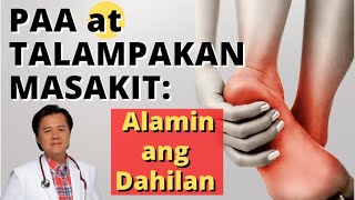 Paa at Talampakan Masakit Alamin ang Dahilan  Payo ni Doc Willie Ong 1331 [upl. by Ibrab33]