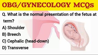 OBG GYNECOLOGY MCQs rrbnursingofficerexam aiimsnorcetmcq [upl. by Eiramac416]