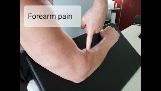 Radial Tunnel Syndrome Forearm pain from screwdriver motion [upl. by Lek516]