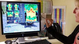 How A Thermography Scan Can Detect A Disease Before It Forms [upl. by Arata166]