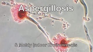 Aspergillosis amp Moldy Indoor Environments [upl. by Yetsirhc]