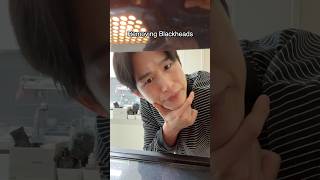 Removing Blackheads using microwave  skincare blackheads [upl. by Yanahs]