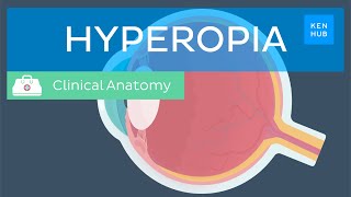 Farsightedness Hyperopia Definition causes symptoms diagnosis and treatment  Kenhub [upl. by Mame]