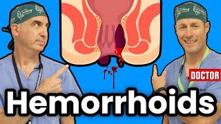 How To Get Rid Of Hemorrhoids [upl. by Miarzim]