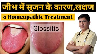 Glossitis  जीभ में सुजन के कारण लक्षण व् इलाज  Glossitis Homeopathic Treatment  Glossitis Tongue [upl. by Adnohsirk]