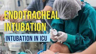 Endotracheal intubation Step by step procedure [upl. by Jazmin601]