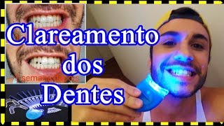 VEMCOMIGO  CLAREAMENTO DENTAL DE VERDADE [upl. by Aratak]