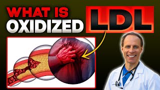 What is Oxidized LDL [upl. by Zerla]