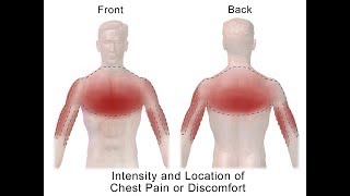 Distinguishing Types of Chest Pain [upl. by Sluiter]