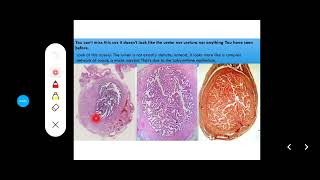 Histology Slides Series Episode 15  Histology of the Female Reproductive Organs and Mammary Gland [upl. by Chemesh945]