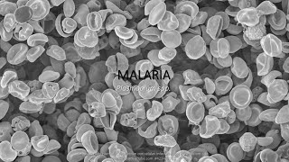 Malaria DEFINICIÓN Y AGENTE CAUSAL notas de estudio [upl. by Nnazus489]