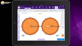 The Ophthalmology EHR System for Retina Specialists [upl. by Hecht]