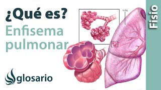 ENFISEMA PULMONAR  Qué es qué estructuras afecta síntomas signos causas y tratamiento [upl. by Eciuqram]