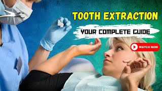 Tooth Extraction Demystified  Your Complete Guide [upl. by Aeret]