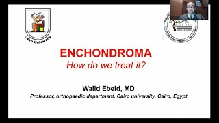 Lecture7  Enchondroma “How do we treat it” 📝🩺 [upl. by Iphigenia]