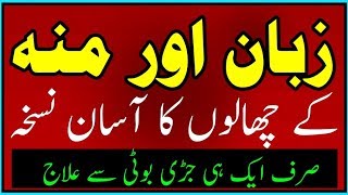 Munh ke chaly ya pakne ka asan ilaj Mouth Ulcer treatmint By Hakeem Zia Shahid [upl. by Hanleigh]