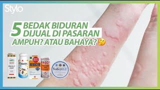 5 Bedak Atasi Biduran Ampuh Obat Kaligata  Kulit Gatal Cocok Setelah Vaksin COVID19  StyloID [upl. by Gillie]