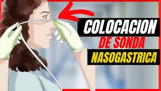 👉😱Colocacion de SONDA NASOGASTRICA cuidados de enfermeria PEDIATRICOS Y ADULTOS TECNICA [upl. by Kries]