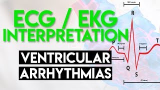 Ventricular Arrhythmias  ECG EKG Interpretation Part 5 [upl. by Briny]