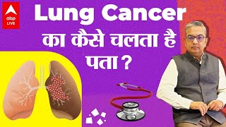 जानें कैसे होता है Lung Cancer  और क्या है इस बीमारी के लक्षण  कैसे होता है इलाज   Hello Doc [upl. by Isidro]