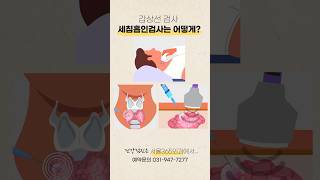 당신의 목에 이상이 갑상선 검사의 충격적 진실 [upl. by Retsim]