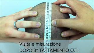 OSTEOPATIA TRICOLOGICA METODO DAMBRA TEST [upl. by Ecertal640]