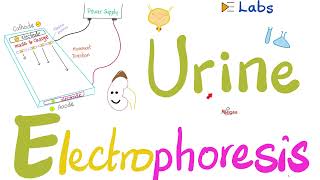 Urine Electrophoresis [upl. by Simona]