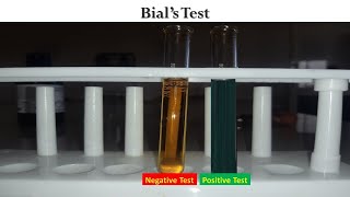 Bials Test [upl. by Nila]