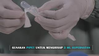 Video Tutorial Pengolahan Spesimen Feses untuk Tes Cepat Molekuler TCM [upl. by Atinuhs]