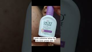 Lacto calamine face lotion review lacto calamine lotion for acne prone skin review shorts [upl. by Minsk]