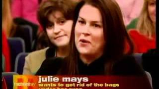 The Non Surgical Eye Lift On The Rachael Ray Show  Dr Cameron Rokhsar  New York [upl. by Hgeilhsa]