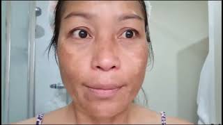 ZooSon Whitening Freckle Cream Review  Miracle Cream 😍  ZooSon SkinCare [upl. by Yarb]