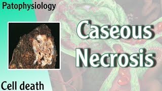 Pathophysiology  Caseous Necrosis Hani Laith شرح [upl. by Aicxela]