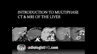 Introduction to Multiphase CT amp MRI of the Liver [upl. by Pasahow]