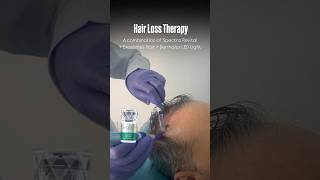 Hair Loss therapy Spectra XT Laser  ASCE Exosomes  Dermalux TriWave Light laserhair exosomes [upl. by Randell]