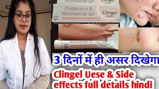 Clingel gel  Clindamycin amp Nicotinamide gel  Clingel review Clingel uese amp Side effects in hindi [upl. by Eves]