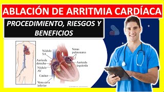 ABLACION CARDIACA POR ARRITMIA [upl. by Geminius]