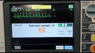 Cardioversione elettrica in paziente ODDIO SI  Fibrillazione atriale ad alta risposta ventricolare [upl. by Callan]