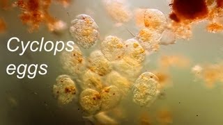 Copepod eggs [upl. by Hubbard]