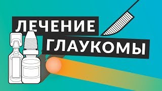 👁️ Лечение глаукомы 👁️ Всё что вы должны знать о лечении глаукомы Доктор Лапочкин [upl. by Nahum]