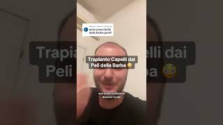 Trapianto di Capelli dai Peli della Barba 😳🤯 trapianto trapiantocapelli trapiantodicapelli [upl. by Etteneg]