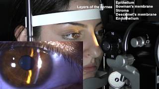 Ophthalmic Skills Series Part 15 [upl. by Ecyal500]