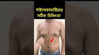 Gynecomastia Result  35k Campaign in Bangladesh  Gynecomastia Treatment Dhaka [upl. by Malvin]