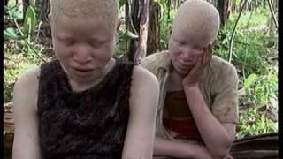 Deadly Hunt Albinos in Tanzania [upl. by Notsag602]