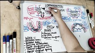 frankel appliance in orthodontics part 2 [upl. by Jethro]