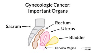 Gynecologic Cancer  What Organs are Impacted [upl. by Laumas]