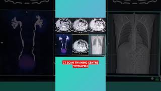 CHECK CT SCAN UROGRAPHY [upl. by Zapot]