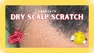 Dry Scalp Inspection 🧐 asmr naturalhair subscribe satisfying [upl. by Enilesor]