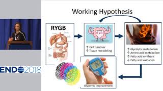 ENDO 2018  News Conference on Obesity [upl. by Llert539]